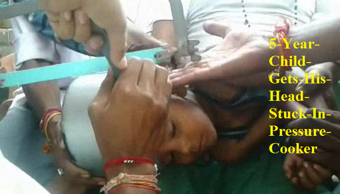 5-Year-Child-Gets-His-Head-Stuck-In-Pressure-Cooker