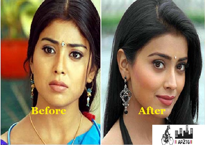 Watch her picture before and after plastic surgery. 