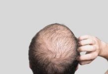 Cells That Cause Hair Growth Accidentally Discovered baldness